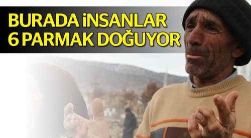 Burada insanlar 6 parmaklı doğuyor