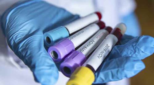 Corona virüs ile ilgili flaş iddia! 'Okullarda ara tatil uzatılacak'