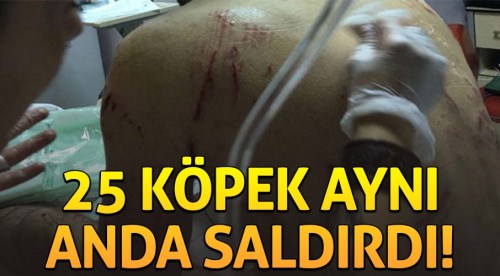 DEHŞET! Ankara'da 25 köpek aynı anda saldırdı!