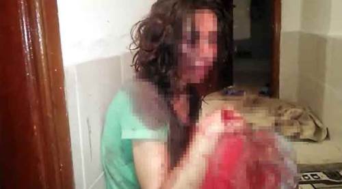 Dehşet! Bu hale getirdi, "kendi kendine yapmıştır" dedi!