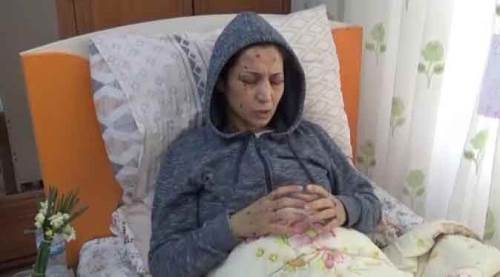 Dehşet! Yeğenini dövdü, yengesini 50 yerinden bıçakladı...