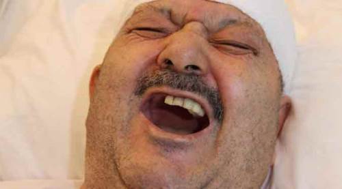 Diş ağrısı diye doktora gitti, gerçeği öğrenince şok oldu!