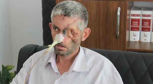 Dişini çektirdi, gözünü kaybetti