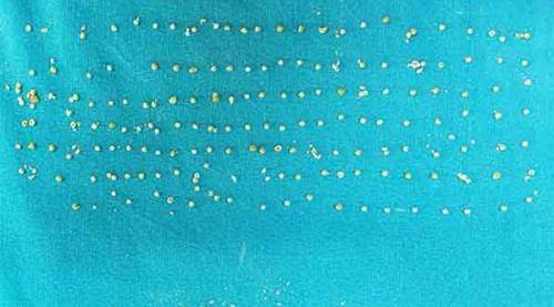 Doktor bile şaşkına döndü