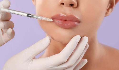 Dudak dolgusu sonrası bunlara dikkat edin!