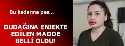 Dudak silikonu faciasında enjekte edilen madde belli oldu