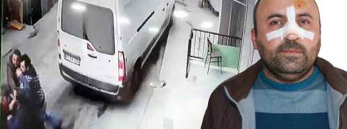 Ekmeği ucuz sattığı için burnunu kırdılar