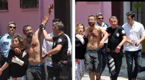 Elindeki bıçakla sokakta dehşet saçtı