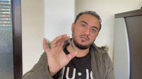 Eline giren bıçakla 2 ay boyunca yaşadı!