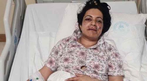 Elti dehşeti: Sokak ortasında ağzından vurdu!