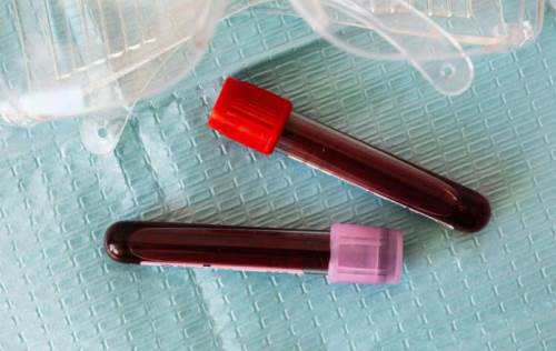 Eskişehir'de 16 yaşındaki genç için acil kan bağışı çağrısı! 