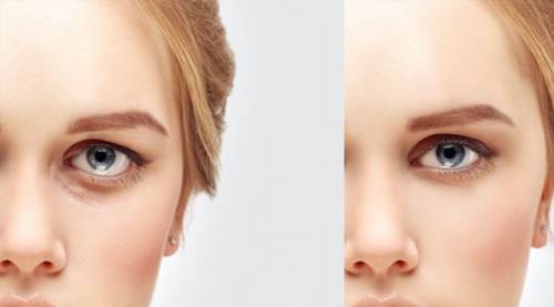 Eskişehir'de bu estetik ameliyat çok revaçta!