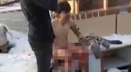 Eskişehir'de feci olay: Vücudunun yarısı yandı!
