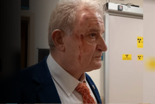 Eskişehir’de gazeteci Hakkı Sağlam’a çirkin saldırı!