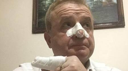 Eskişehir'de gazeteci Hakkı Sağlam'a saldırı