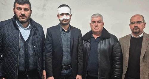 Eskişehir'de hangi iddia doğru? Öğretmenlerin kavgasına çarpıcı açıklama