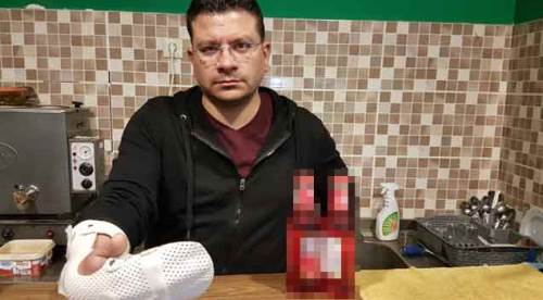 Eskişehir'de inanılmaz olay! Soda şişesi patlayınca...