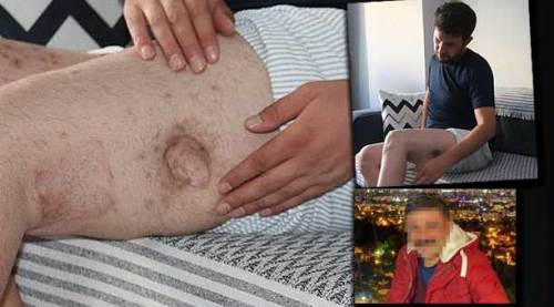 Eskişehir'de iyilik yaptı: Önce vuruldu sonra icralık oldu