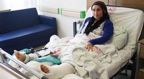 Eskişehir'de kadın işçi forkliftin altında kaldı, doktorlar mucize yarattı