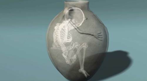 Eskişehir'de kesik parmaklı 5 bin yıllık gizem çözüldü