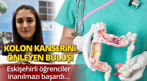 Eskişehir'de kolon kanserini önleyen buluş