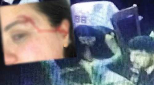 Eskişehir'de korkunç anlar: Yüzünden böyle ısırıldı!