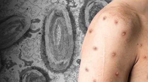 Eskişehir de Maymun Çiçeğine kenetlendi ama asıl salgın başka!