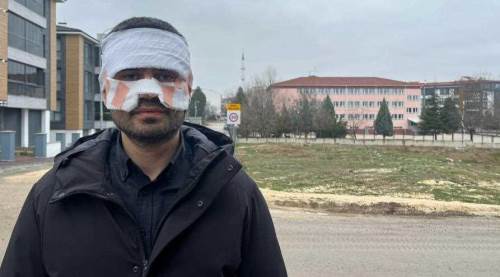 Eskişehir'de meslektaşını çay ile yakan öğretmen serbest kaldı