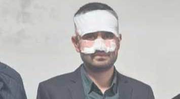 Eskişehir'de öğretmenden korkunç saldırı