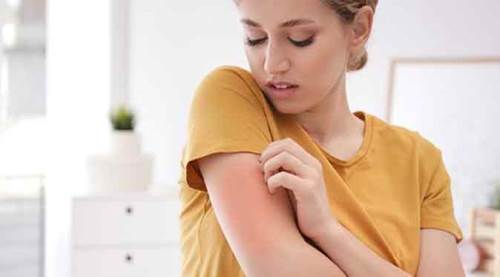 Eskişehir’de önemli uyuz salgını açıklaması