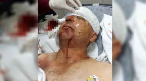 Eskişehir'de polisi darp etti, “hatırlamıyorum” dedi!