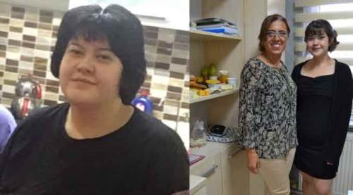 Eskişehir'de sadece 8 ayda tam 50 kilo verdi