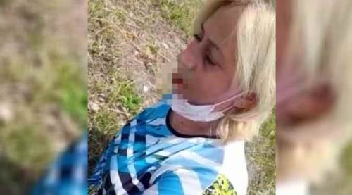 Eskişehir'de sokak hayvanlarını beslemek istedi, çenesini kırdılar!
