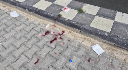 Eskişehir'de sokak ortasında 16 yaşındaki çocuğa bıçaklı saldırı