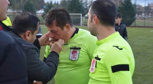 Eskişehir'de teknik direktörden hakeme feci saldırı!