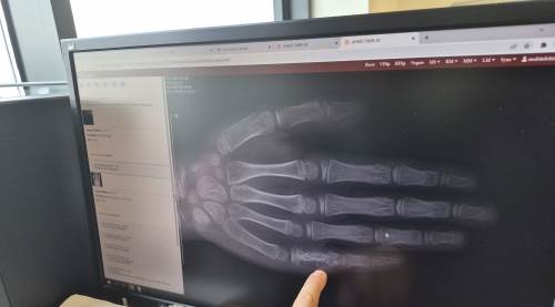 Eskişehir’de ürküten tablo: Uzmanlardan kritik uyarı!