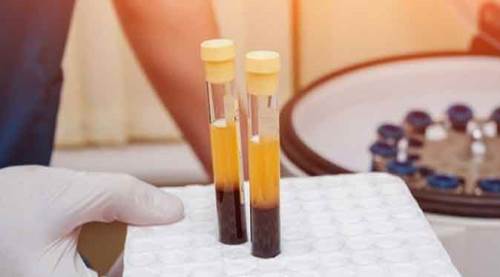 Eskişehir'de uzmanı açıkladı: Bu tedavi pek çok sorunun çözümü 