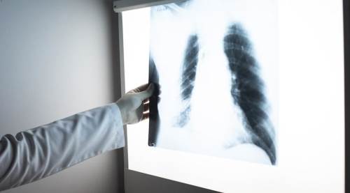 Eskişehir’de uzmanından hayati uyarı: Bu belirtileri hafife almayın!