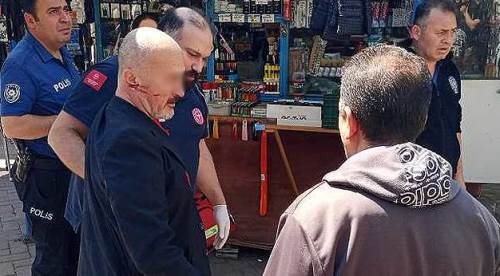 Eskişehir'de yaşlı adama akılalmaz saldırı