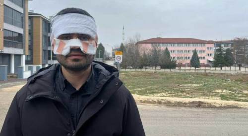 Eskişehir'de yüzüne kaynar çay fırlatılmıştı: Korkunç anları böyle anlattı