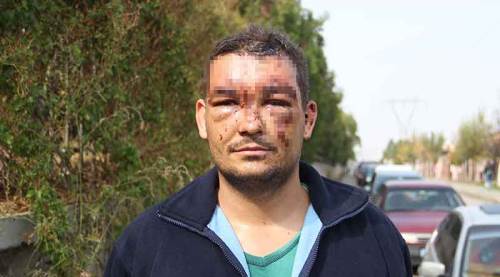 Eskişehir’deki korkunç kazadan böyle kurtuldu!