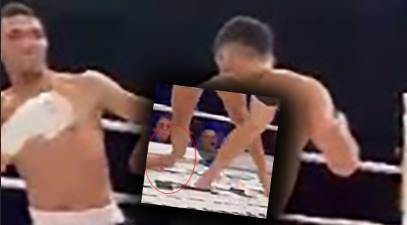 Eskişehir’deki maçta büyük talihsizlik: Kemiği kırıldı