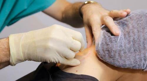 Eskişehir Şehir Hastanesi'ne bunun için de geliyorlar