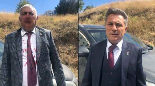 Eskişehirli isimden flaş darp iddiası: Ümit Özdağ azmettirdi, 20 kişi saldırdı!