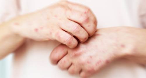 Eskişehirliler doktoru pas geçmeyin: Giderek yayılıyor!