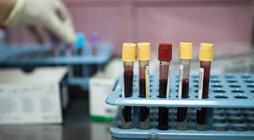 Eskişehirlilere müjdeyi verdi: Sağlığınız için hepsi ücretsiz!