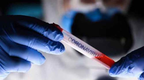 Eskişehirspor'da bir koronavirüs şoku daha!