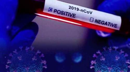 Eskişehirspor’da koronavirüs depremi! Yönetime de sıçradı...