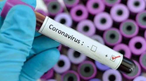 Eskişehirspor'da koronavirüs şoku!..