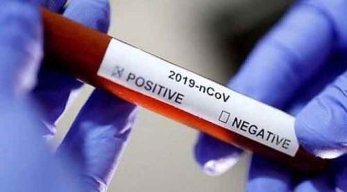 Eskişehirspor'da koronavirüs şoku